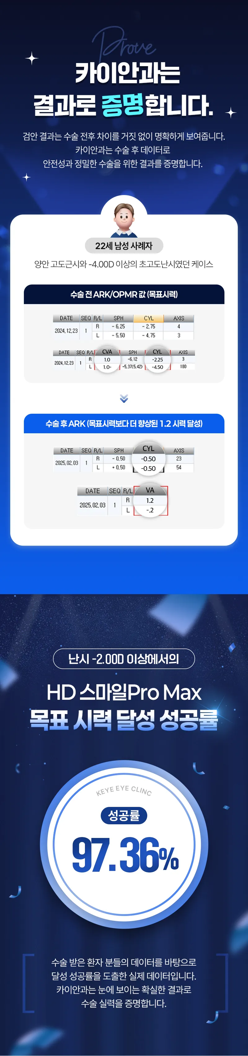 카이안과 홍채인식 스마일프로 이벤트 이벤트, 시술 상세 이미지