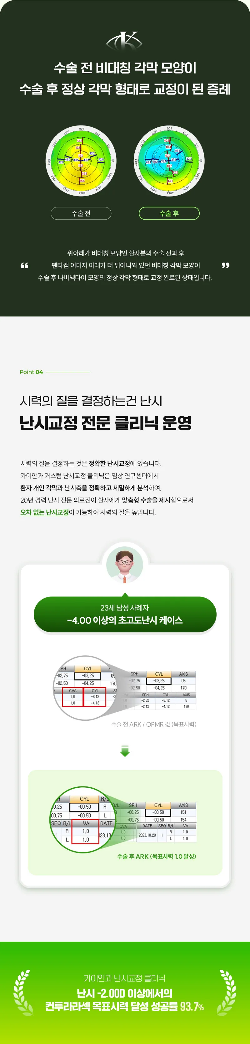 카이안과 개인 맞춤형 컨투라라섹 특별  혜택가 이벤트, 시술 상세 이미지