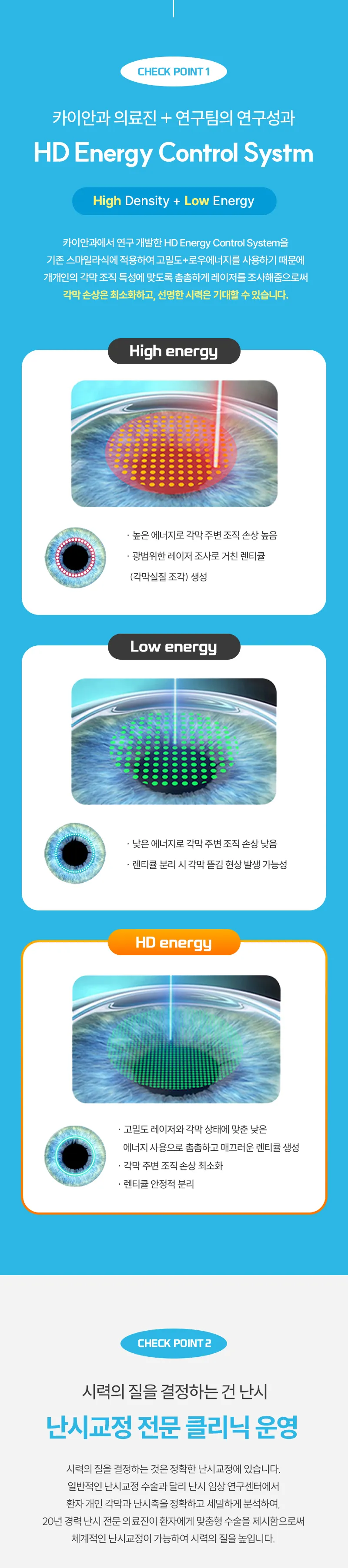 카이안과 정품 스마일라식 이벤트 이벤트, 시술 상세 이미지