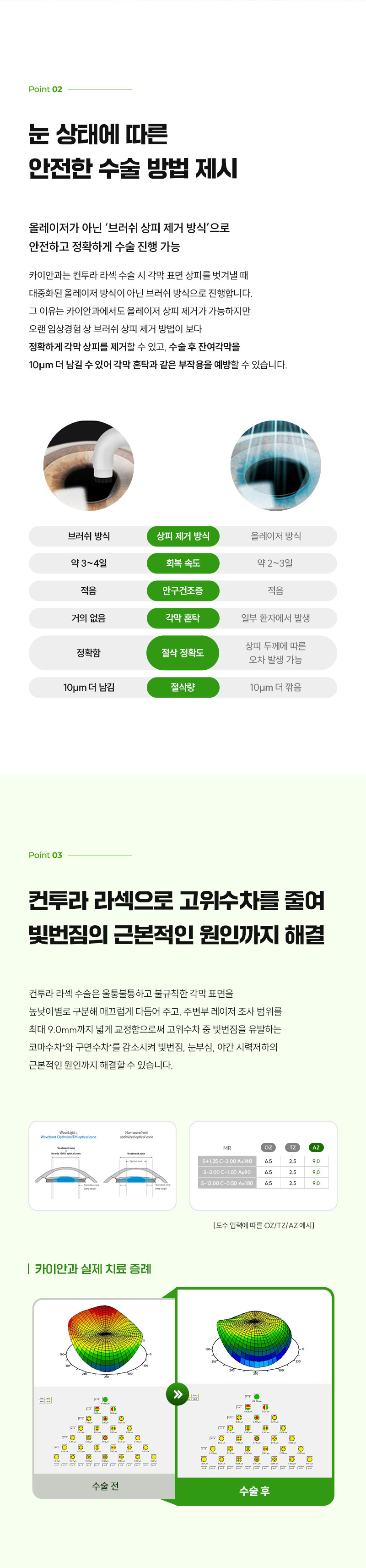 카이안과 개인 맞춤형 컨투라라섹 특별  혜택가 이벤트, 시술 상세 이미지