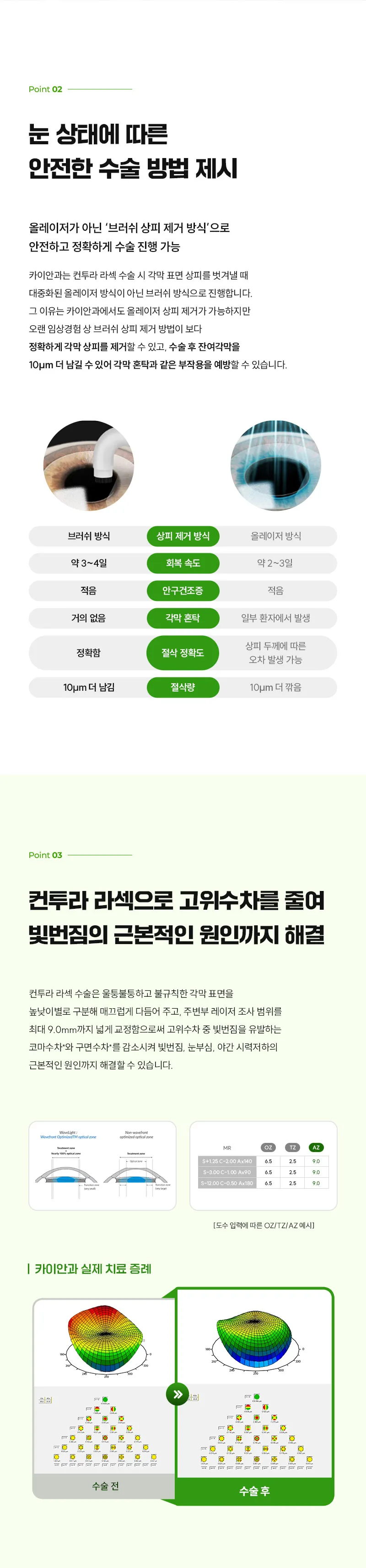 카이안과 개인 맞춤형 컨투라라섹 특별  혜택가 이벤트, 시술 상세 이미지