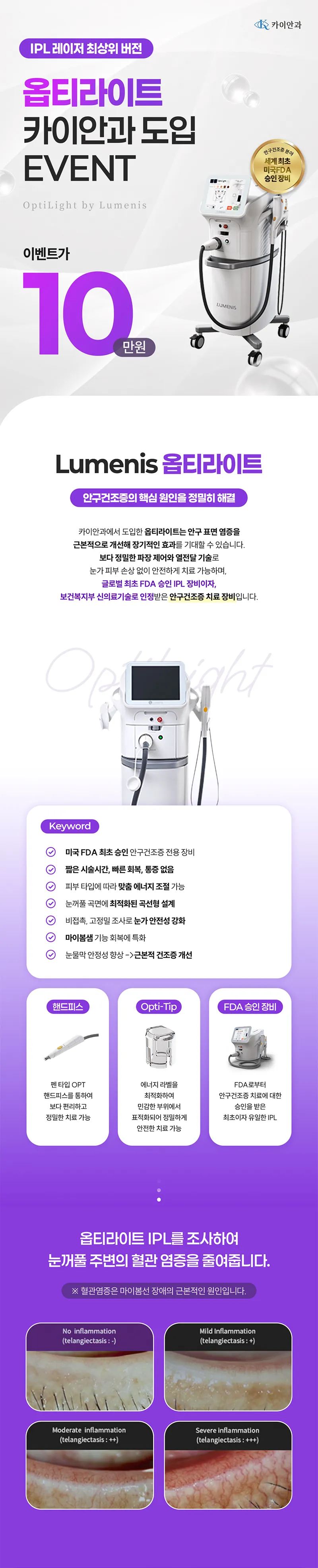 카이안과 안구건조증치료 할인 이벤트 이벤트, 시술 상세 이미지