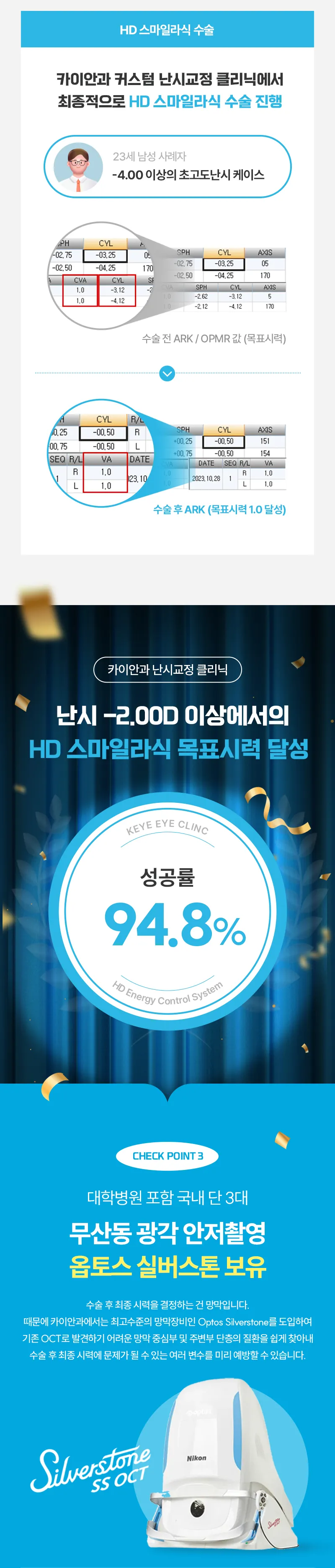 카이안과 정품 스마일라식 이벤트 이벤트, 시술 상세 이미지