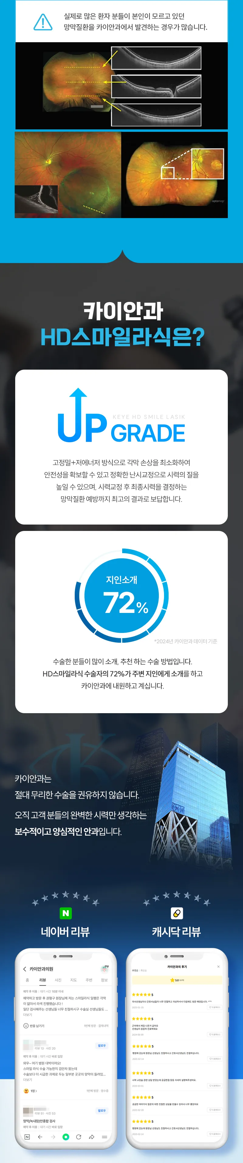 카이안과 정품 스마일라식 이벤트 이벤트, 시술 상세 이미지
