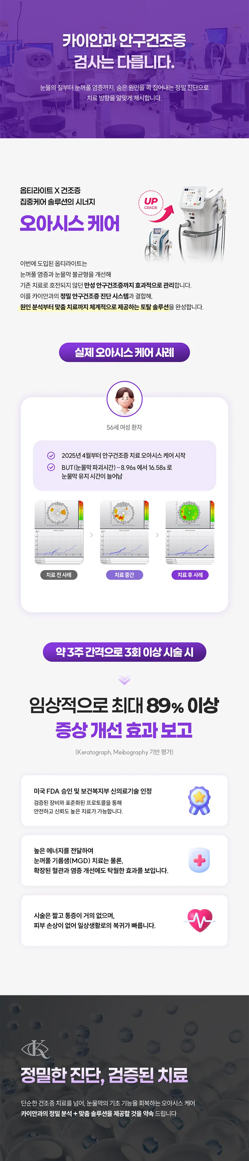 카이안과 안구건조증치료 할인 이벤트 이벤트, 시술 상세 이미지