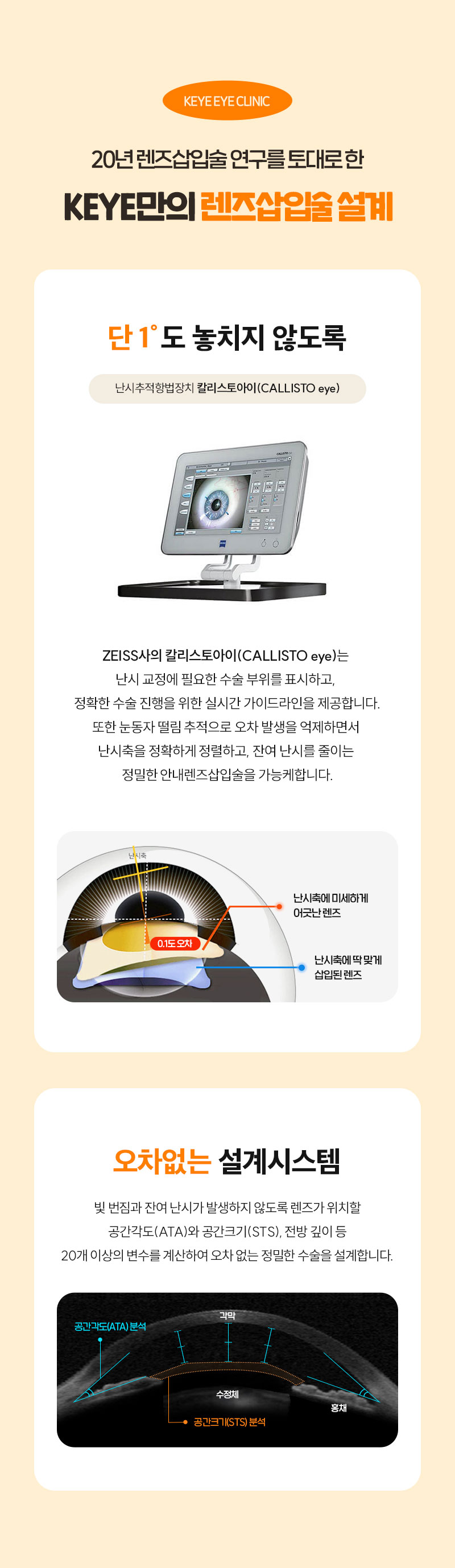 카이안과 가장 안전한 안내렌즈삽입술 이벤트, 시술 상세 이미지