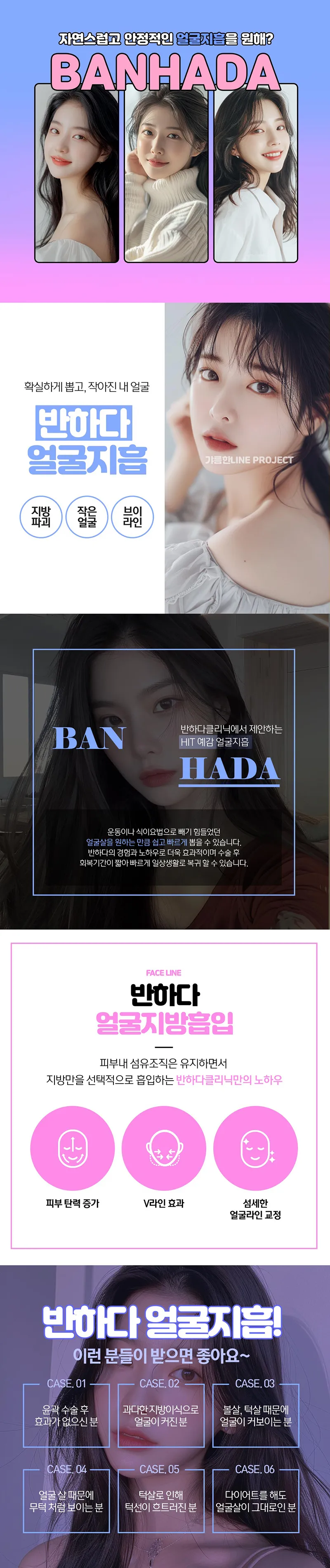 반하다의원 갸름한얼굴 이중턱지방흡입 이벤트, 시술 상세 이미지