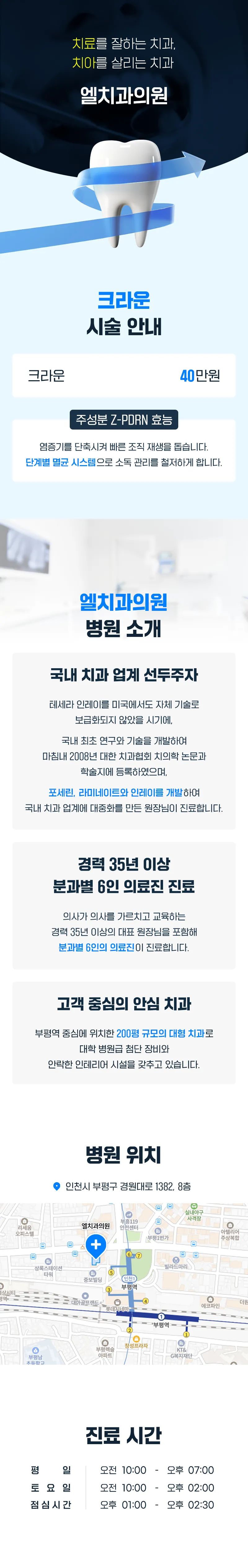 엘치과의원 인천 크라운 40만원 이벤트, 시술 상세 이미지