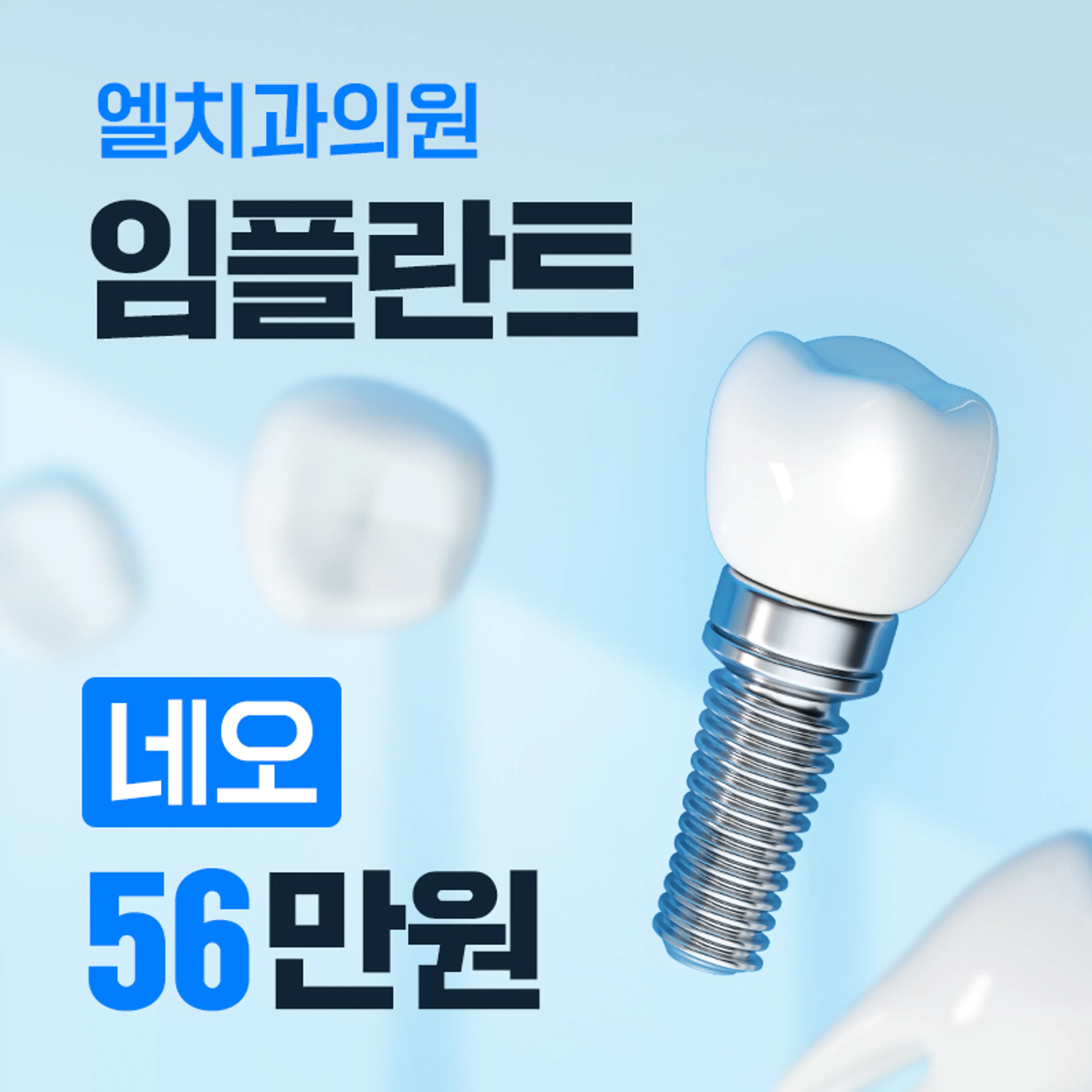 인천 네오 임플란트 56만원