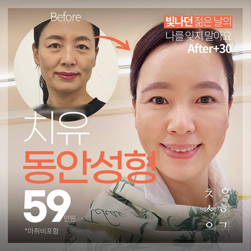 치유🌿중년동안모음zip 이벤트 썸네일 이미지