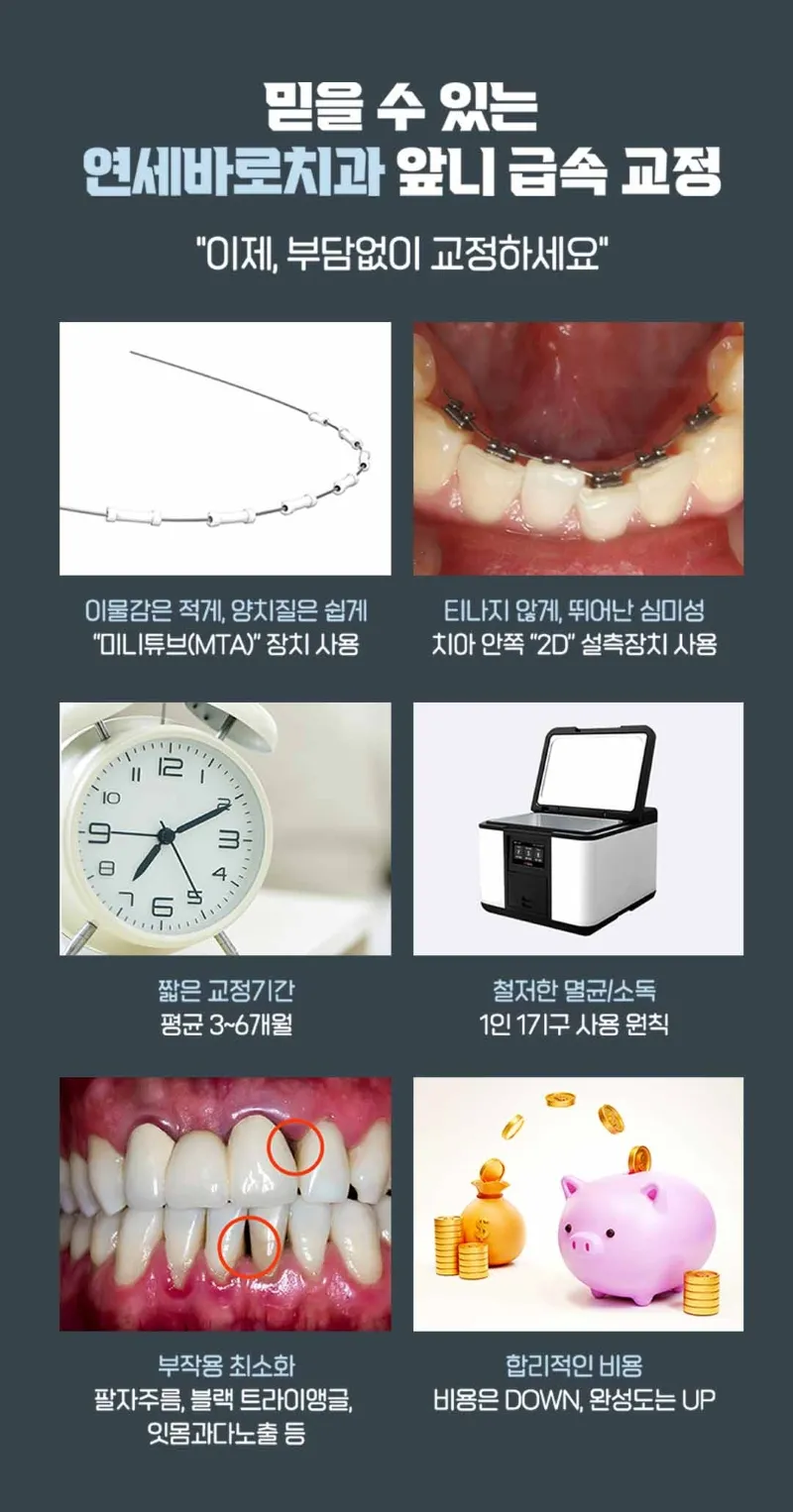 연세바로치과의원 압구정점 연세바로-앞니급속교정 이벤트, 시술 상세 이미지