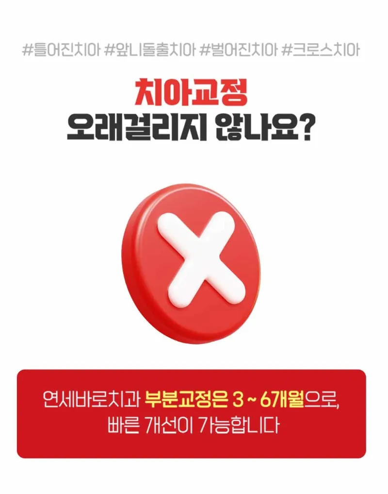 연세바로치과의원 압구정점 연세바로-앞니급속교정 이벤트, 시술 상세 이미지