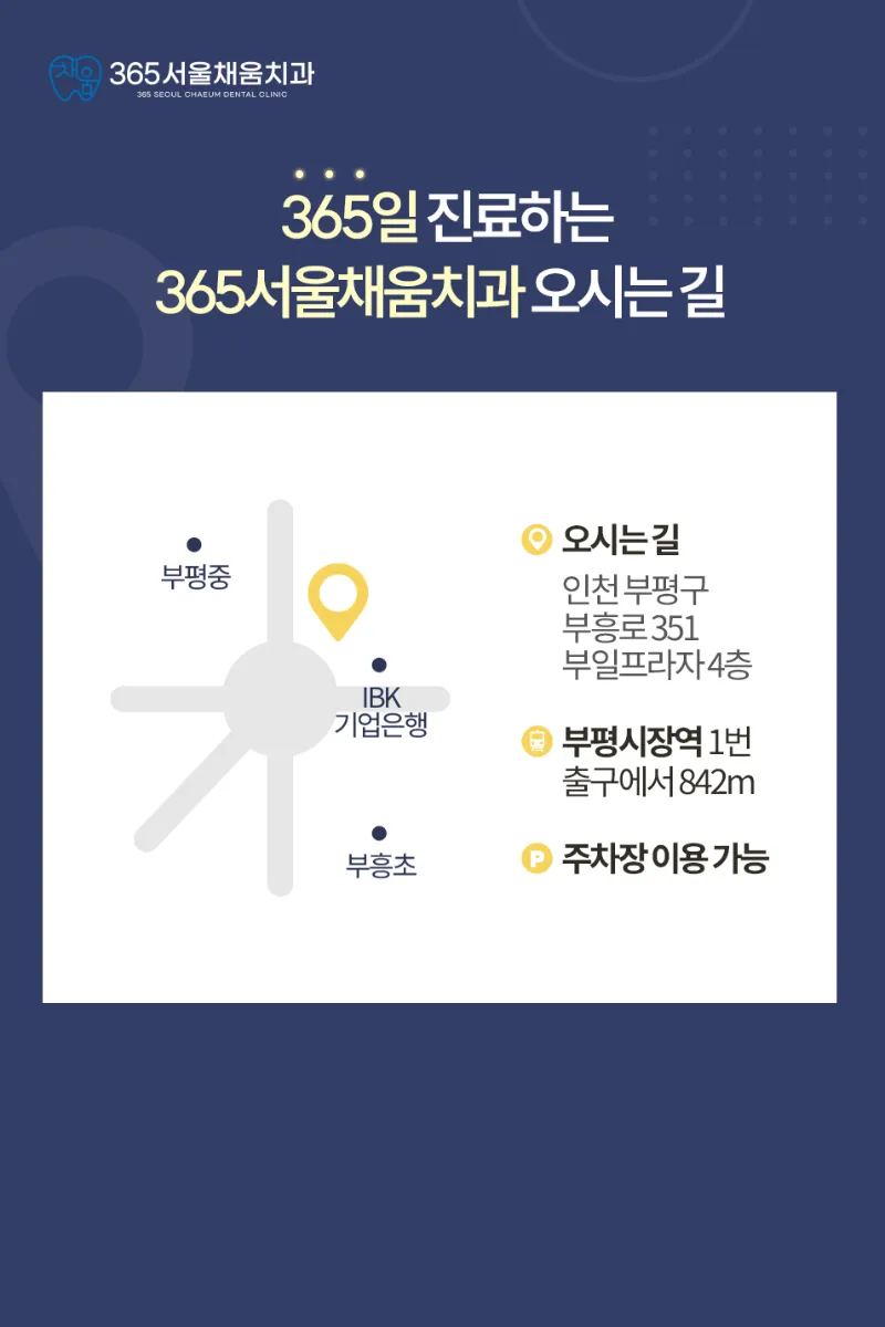 365서울채움치과의원 부평 미소채움 원데이 치아미백 3회 이벤트, 시술 상세 이미지