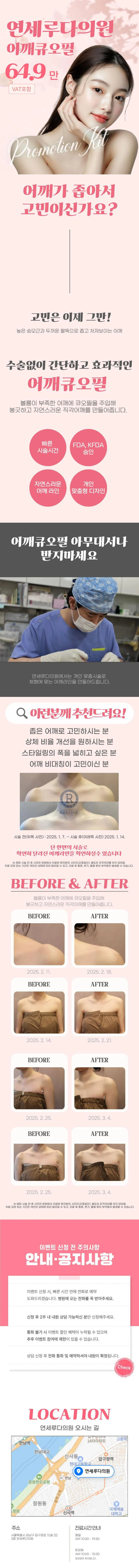 연세루다의원 연세루다어깨큐오필10cc 이벤트, 시술 상세 이미지