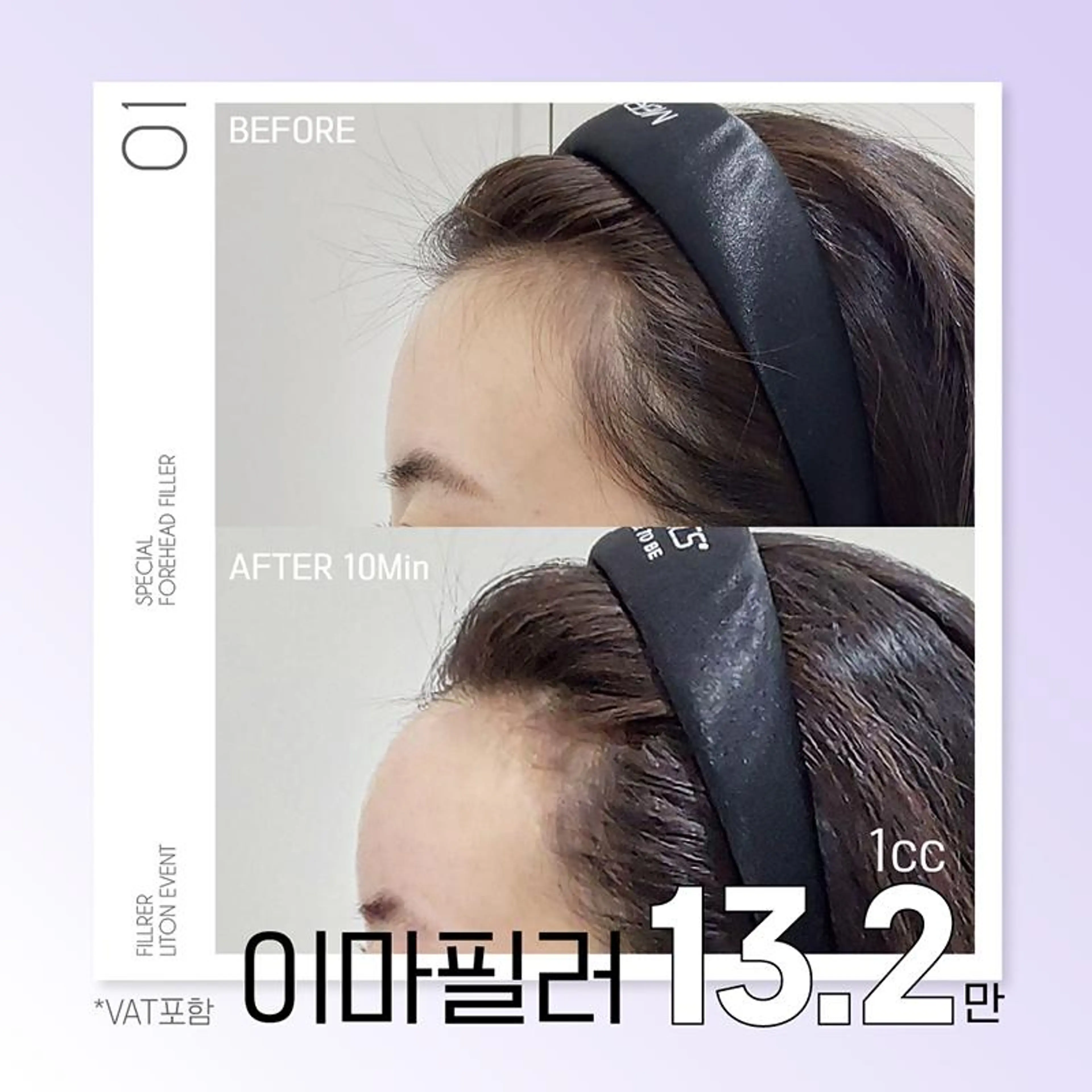 리프톤 이마필러