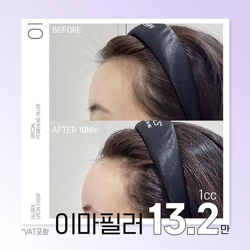 리프톤 이마필러 이벤트 썸네일 이미지