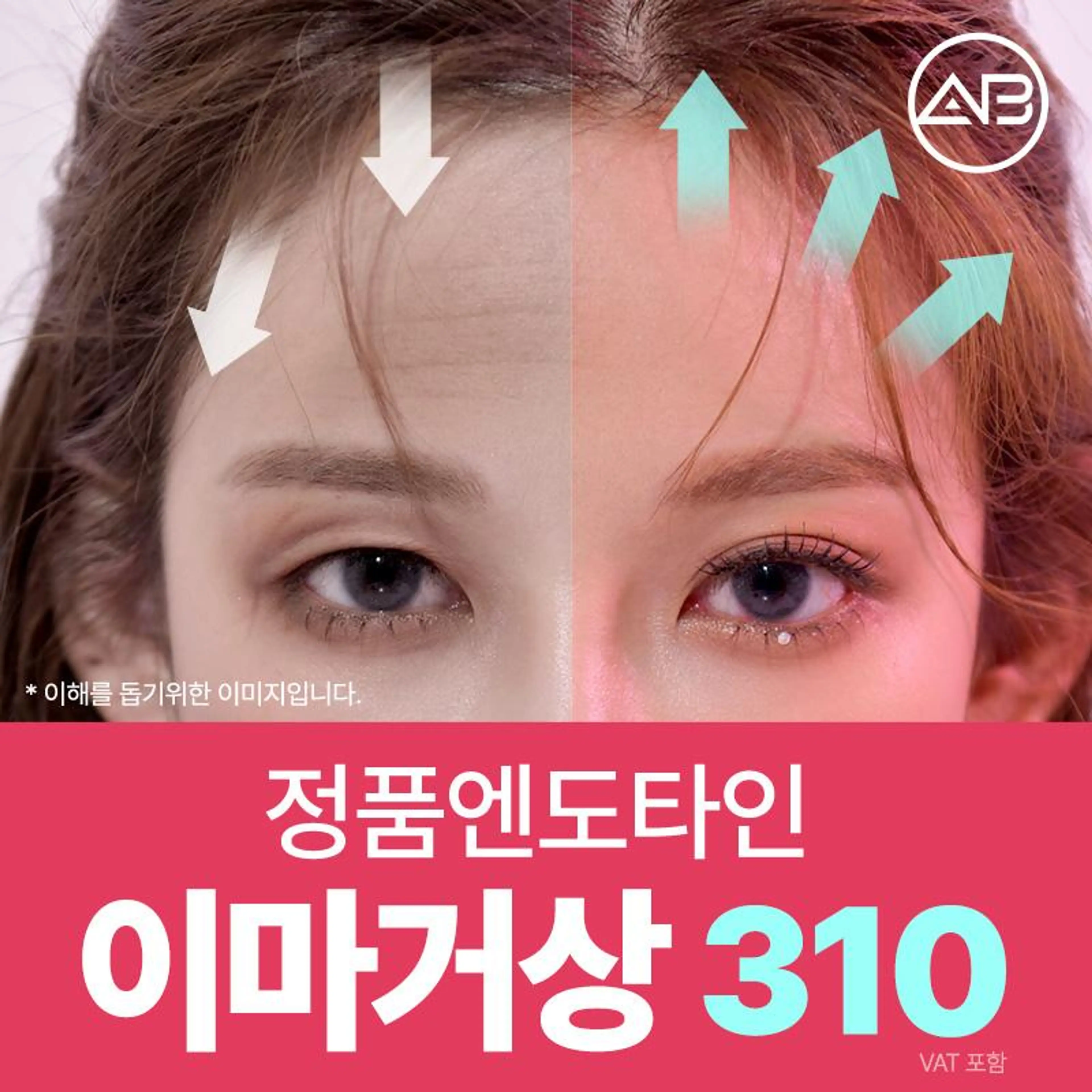 에이비 내시경이마거상