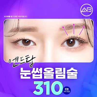 에이비 눈썹올림술 이벤트 썸네일 이미지