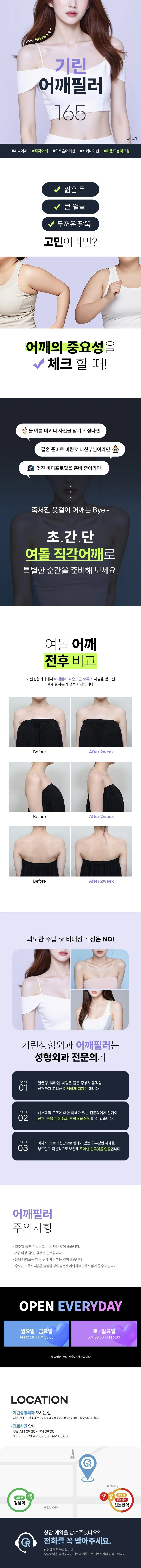 기린성형외과의원 기린 어깨필러 이벤트, 시술 상세 이미지