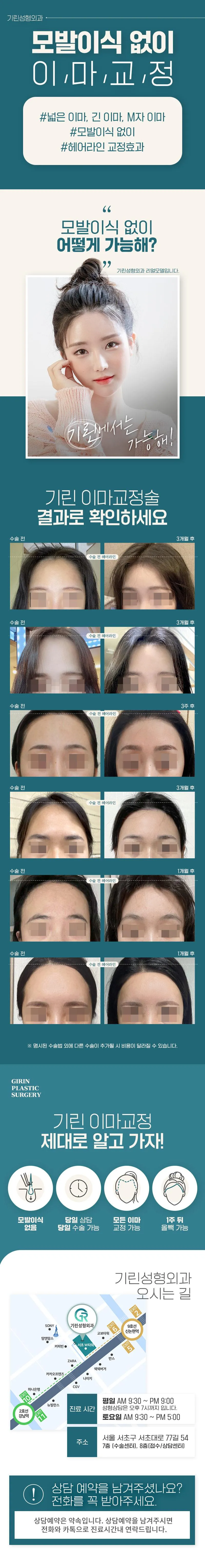 기린성형외과의원 모발이식 없이 이마교정 이벤트, 시술 상세 이미지