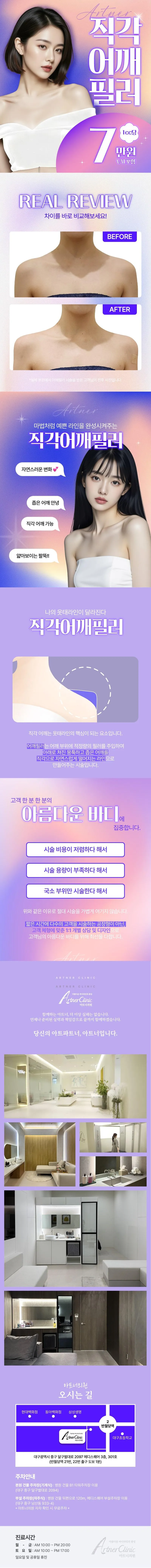 아트너의원 대구 직각 어깨필러 윤곽주사 이벤트, 시술 상세 이미지