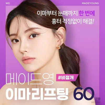 비절개 이마리프팅 이벤트 썸네일 이미지