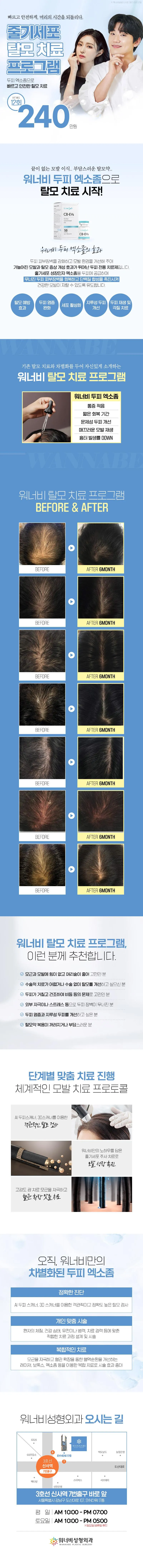 워너비성형외과의원 워너비 줄기세포 엑소좀 이벤트, 시술 상세 이미지