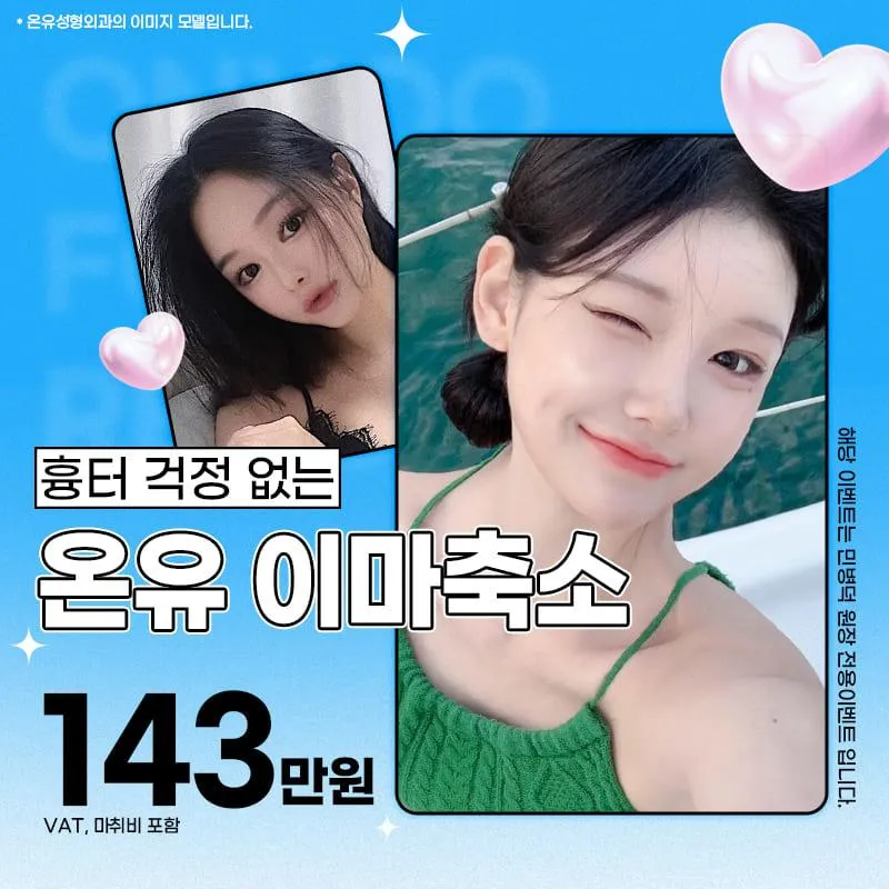 흉터 걱정 없는 이마축소 이벤트 썸네일 이미지