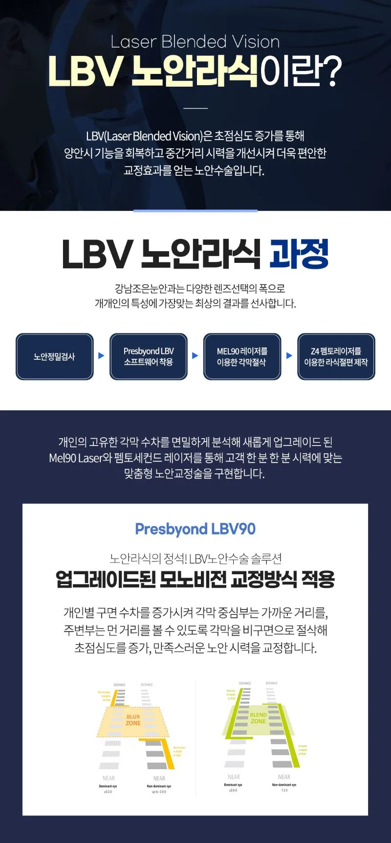 강남조은눈안과의원 LBV 노안라식 이벤트, 시술 상세 이미지