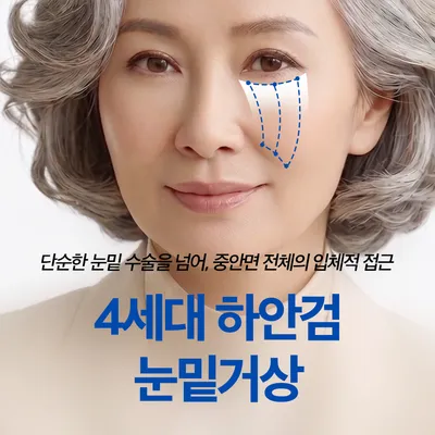 불룩하고 어두워 보이는 눈밑을 매끈하게_하안검지방재배치 이벤트 썸네일 이미지