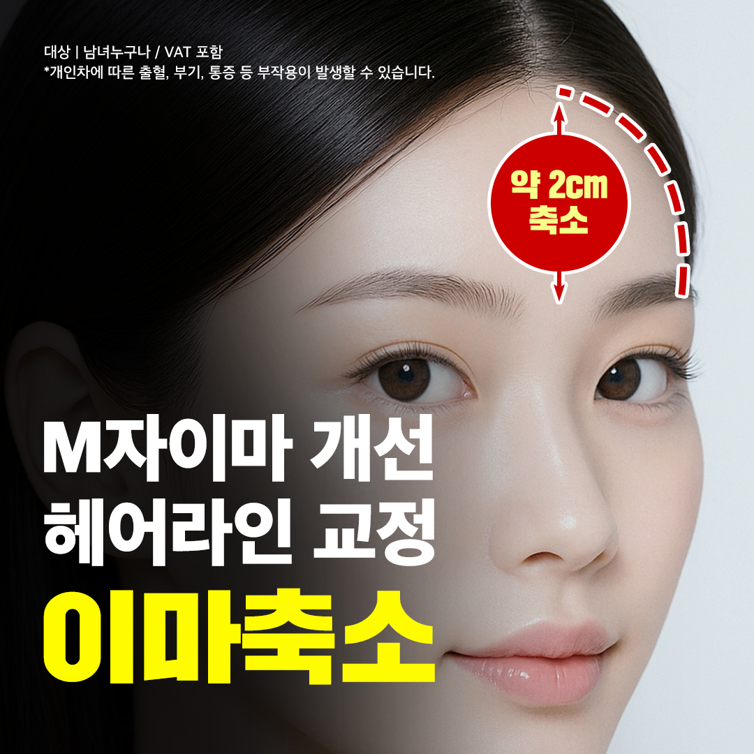 넓은이마 고민_이마축소 이벤트 썸네일 이미지