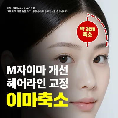 넓은이마 고민_이마축소 이벤트 썸네일 이미지
