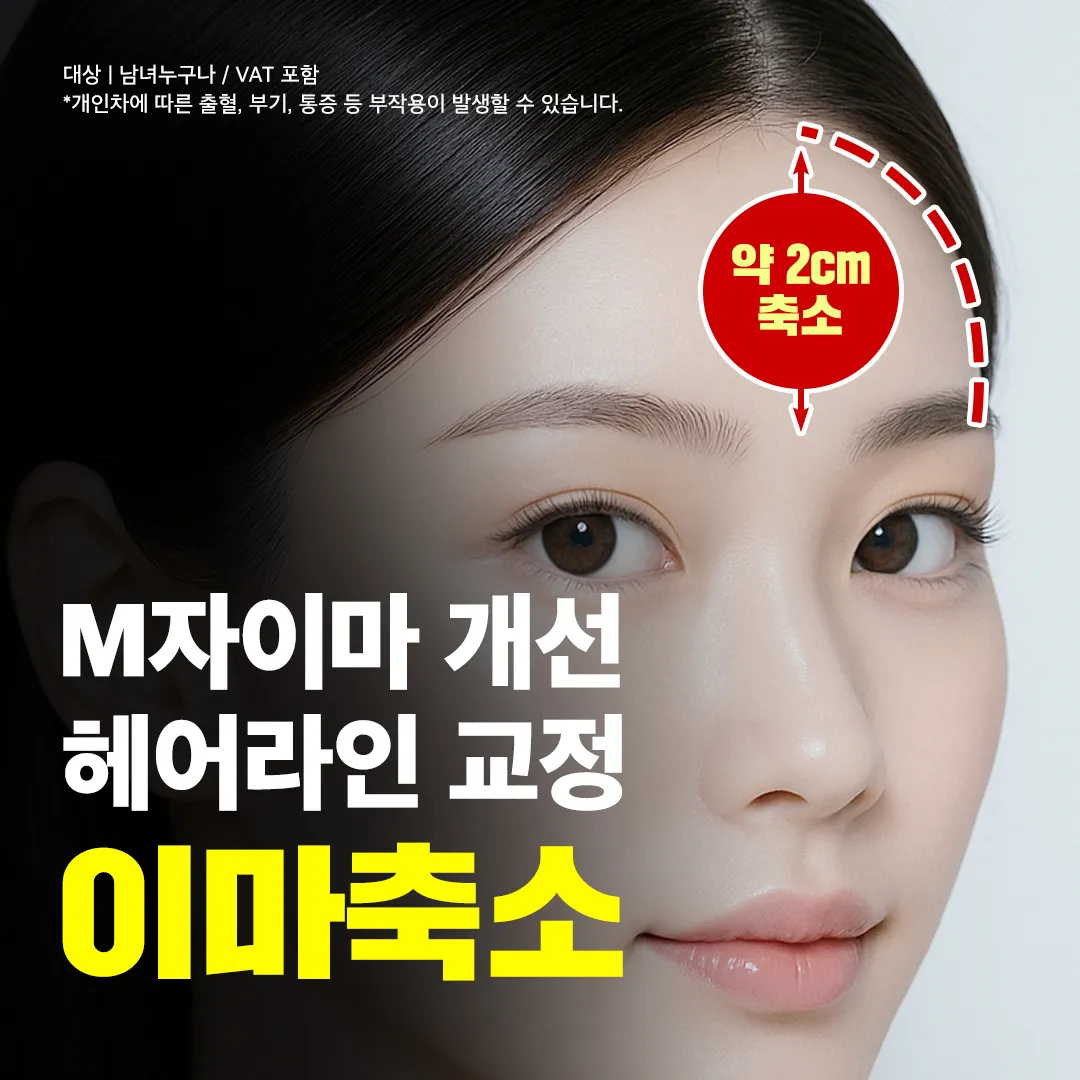 넓은이마 고민_이마축소