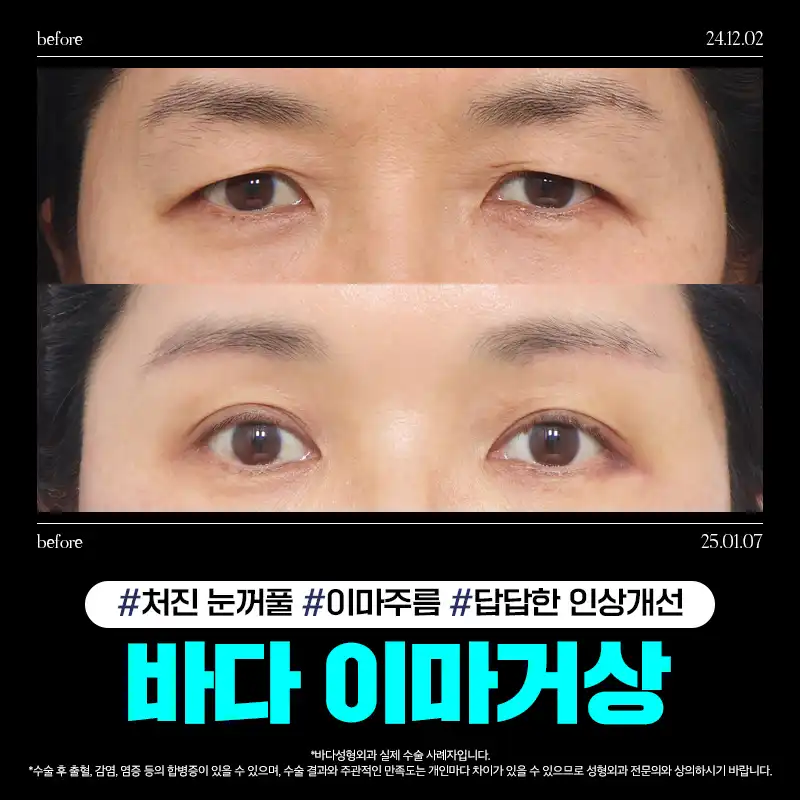 바다 내시경 이마거상