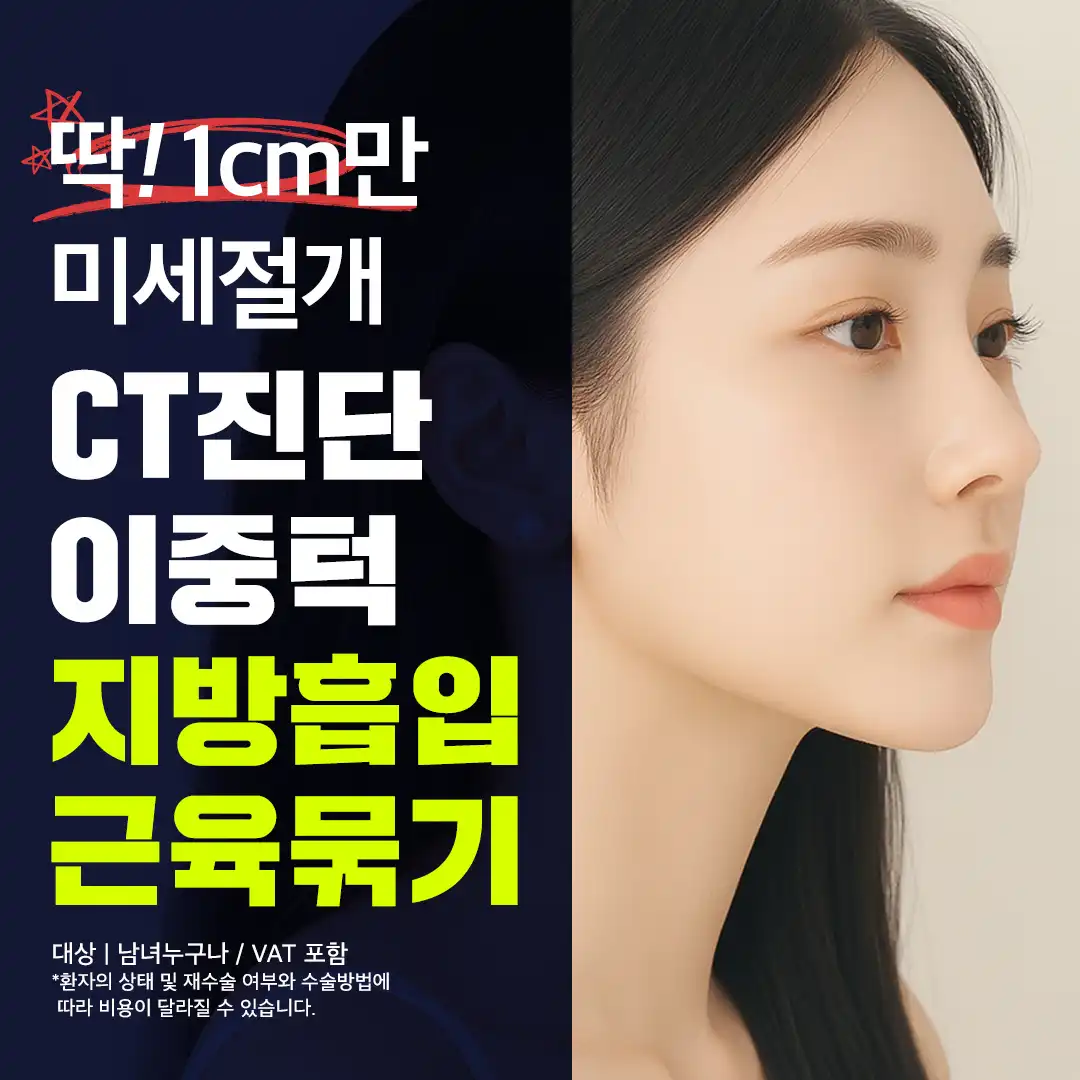 이중턱 지방흡입, 근육묶기_1cm 절개, CT진단