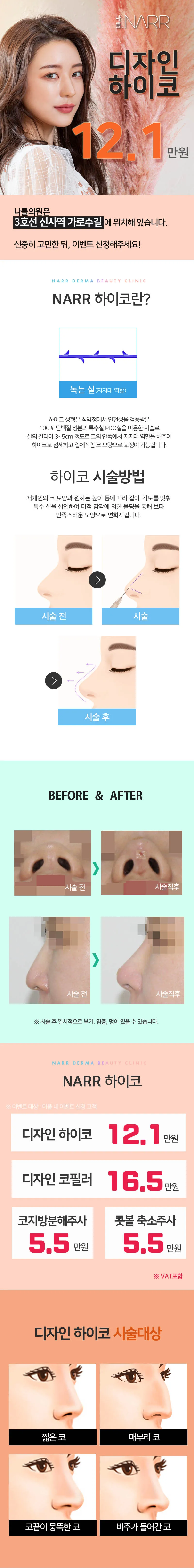 나를의원 디자인 하이코 이벤트, 시술 상세 이미지