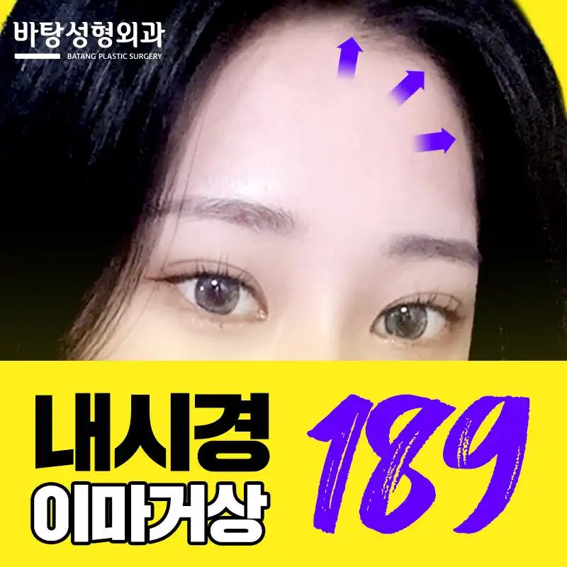 내시경 이마거상술 바탕