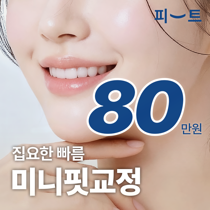 미니핏 급속교정 집요한 빠름 앞니교정 이벤트 썸네일 이미지