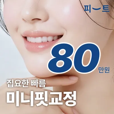 미니핏 급속교정 집요한 빠름 앞니교정 이벤트 썸네일 이미지