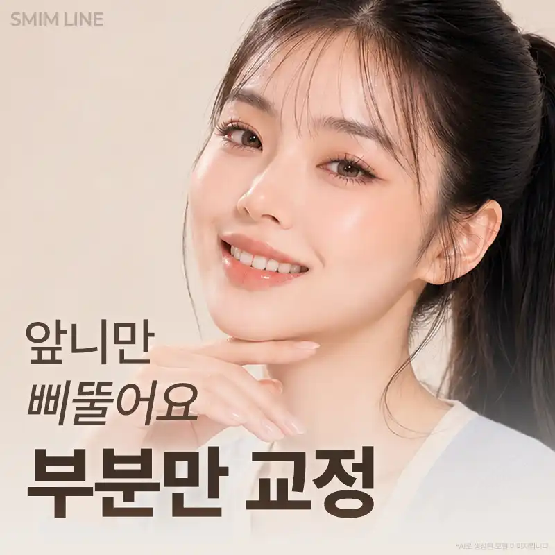 미니핏 급속교정 집요한 빠름 앞니교정