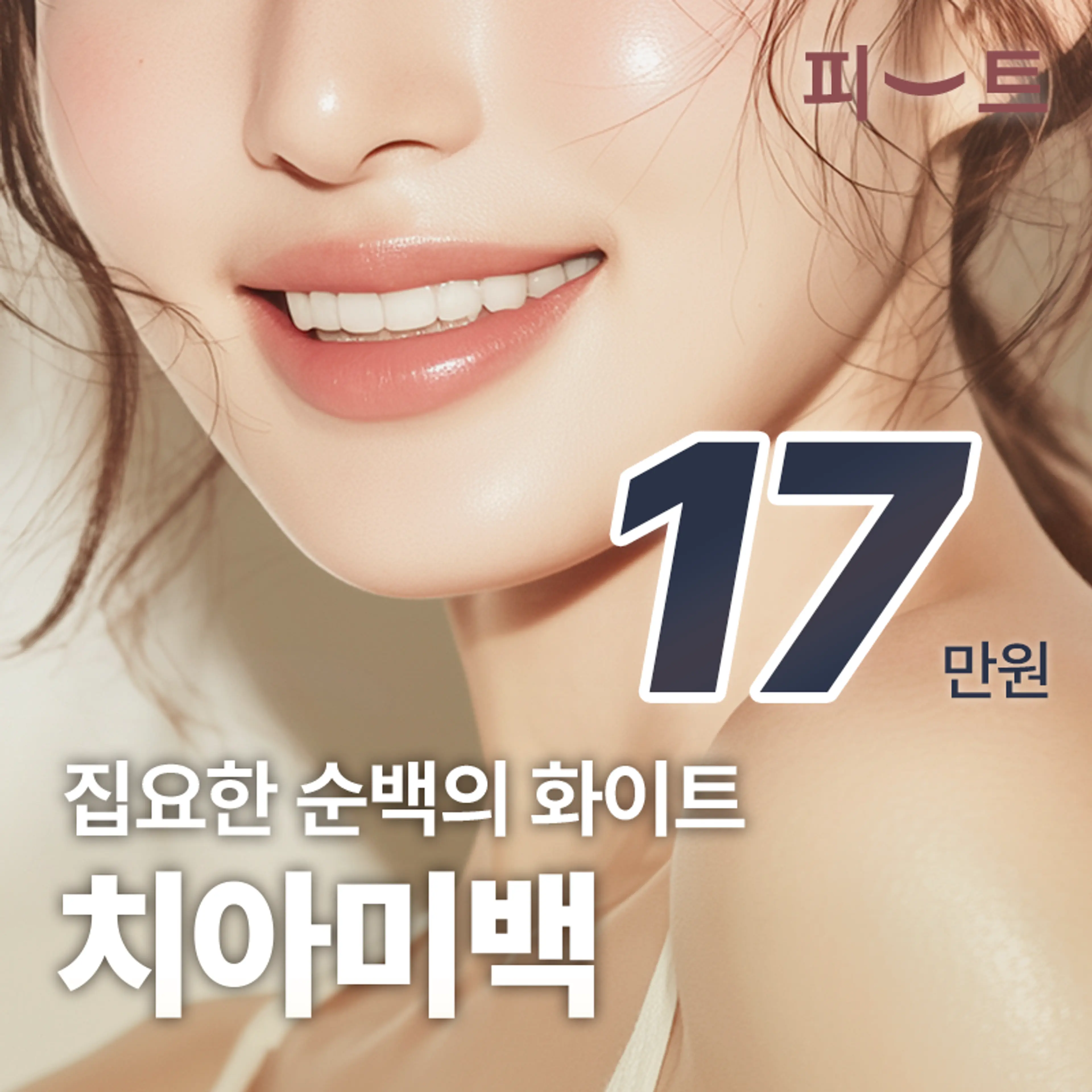 치아미백 3회 원데이치과미백패키지