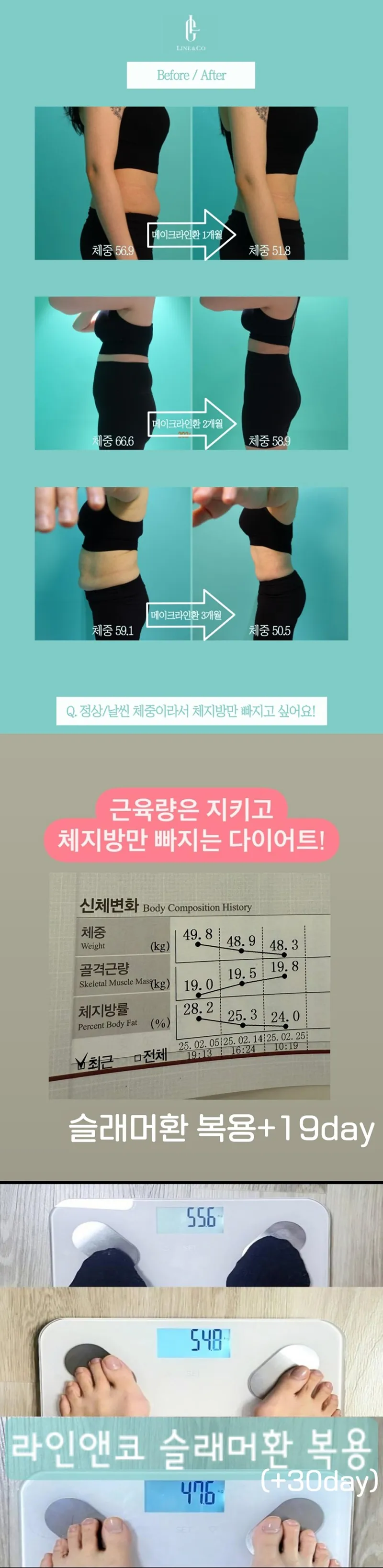 라인앤코한의원 부작용없이 평생 유지가능 다이어트한약 이벤트, 시술 상세 이미지