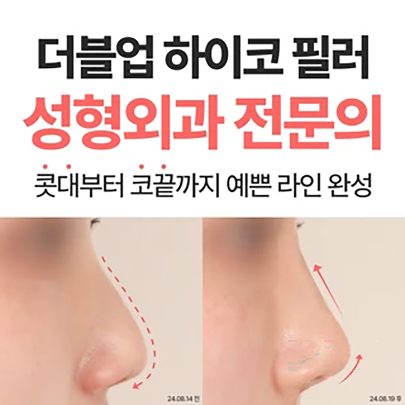 더블업 하이코 필러 성형외과 전문의 이벤트 썸네일 이미지