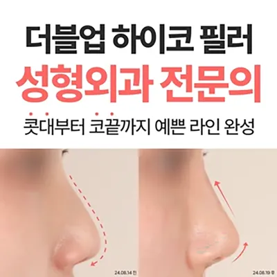더블업 하이코 필러 성형외과 전문의 이벤트 썸네일 이미지