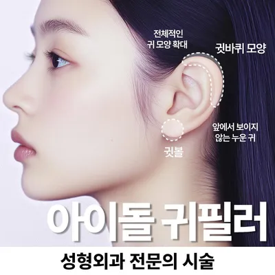 누운귀 귓볼필러 귀필러 이벤트 썸네일 이미지