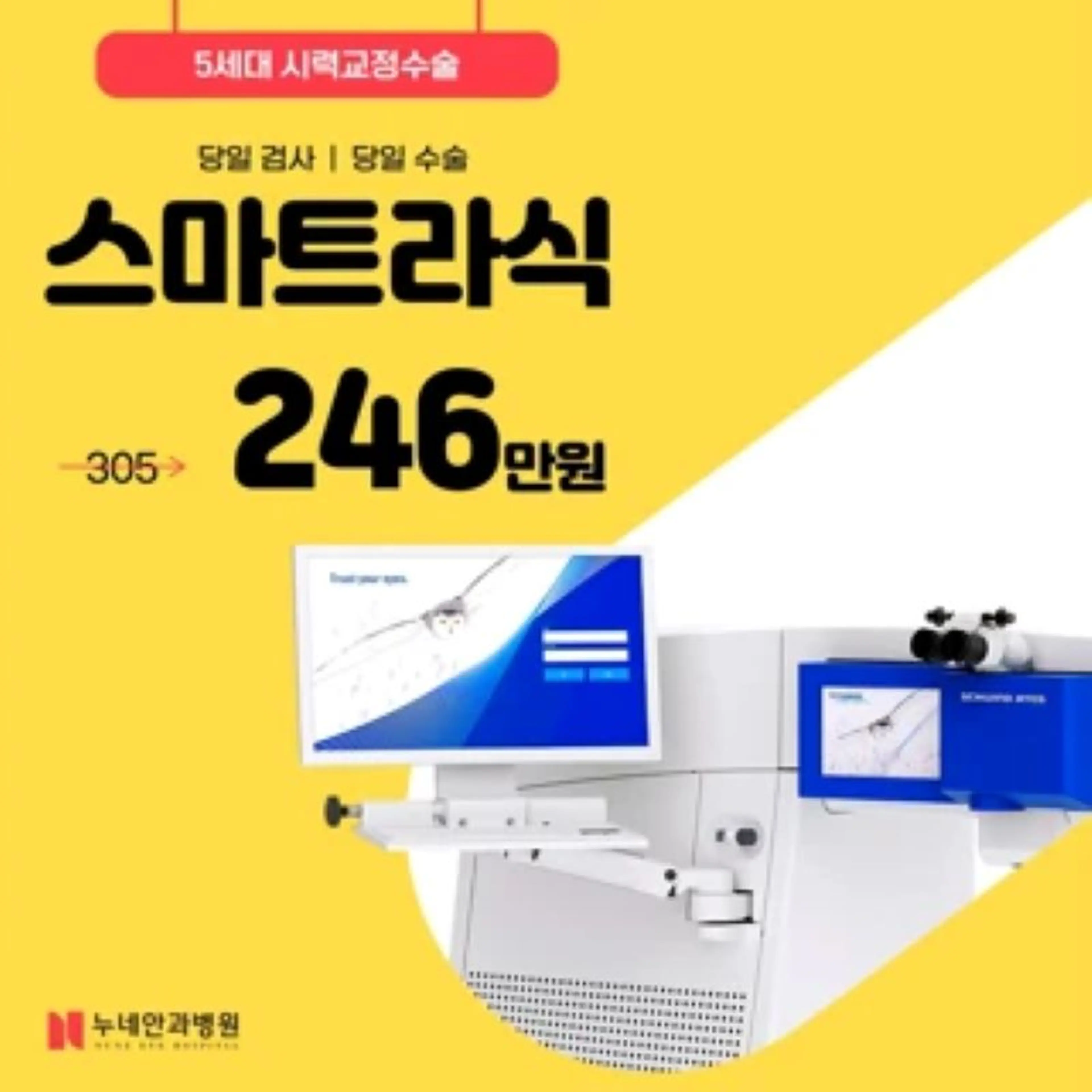 스마일라식 그 이상, 스마트라식