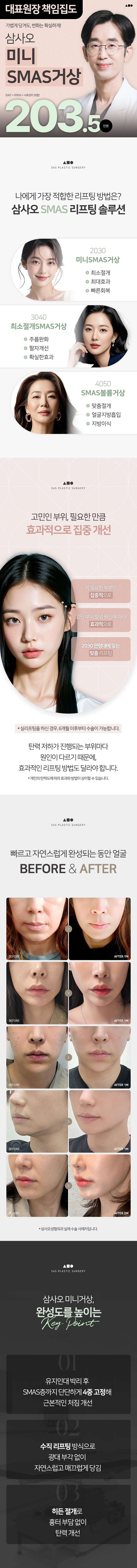 삼사오성형외과의원 삼사오 원데이 SMAS 미니리프팅 이벤트, 시술 상세 이미지
