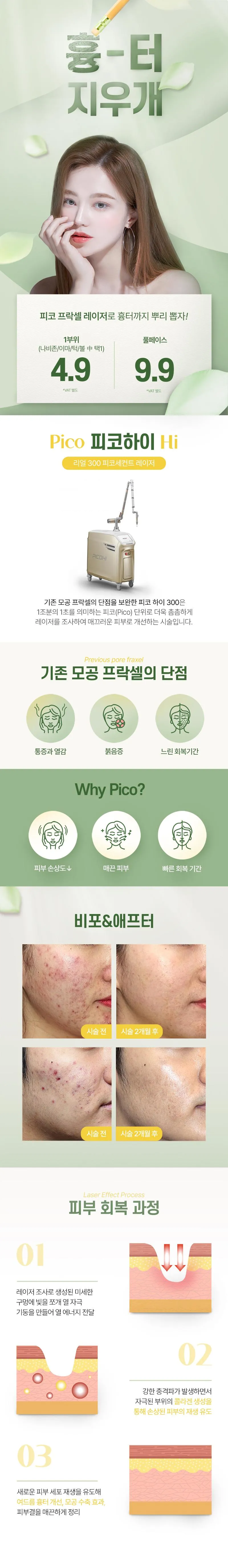 오크우드봄의원 여드름 흉터제거 이벤트, 시술 상세 이미지