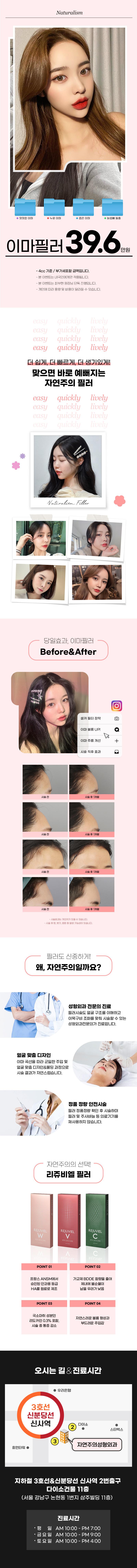 자연주의성형외과의원 자연주의 이마필러 이벤트, 시술 상세 이미지