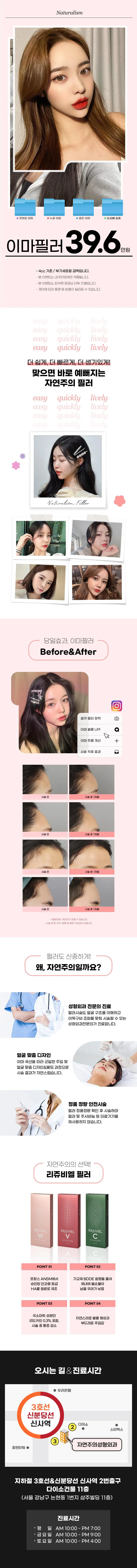 자연주의성형외과의원 자연주의 이마필러 이벤트, 시술 상세 이미지